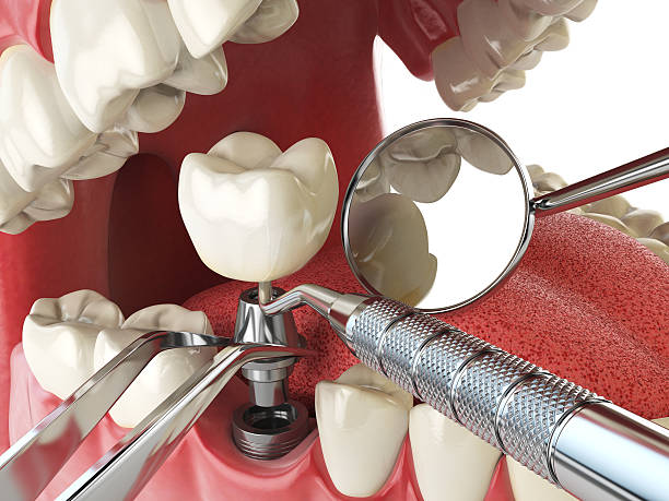 Best Emergency Treatment for Dental Infections or Abscesses in Greenfield, MN